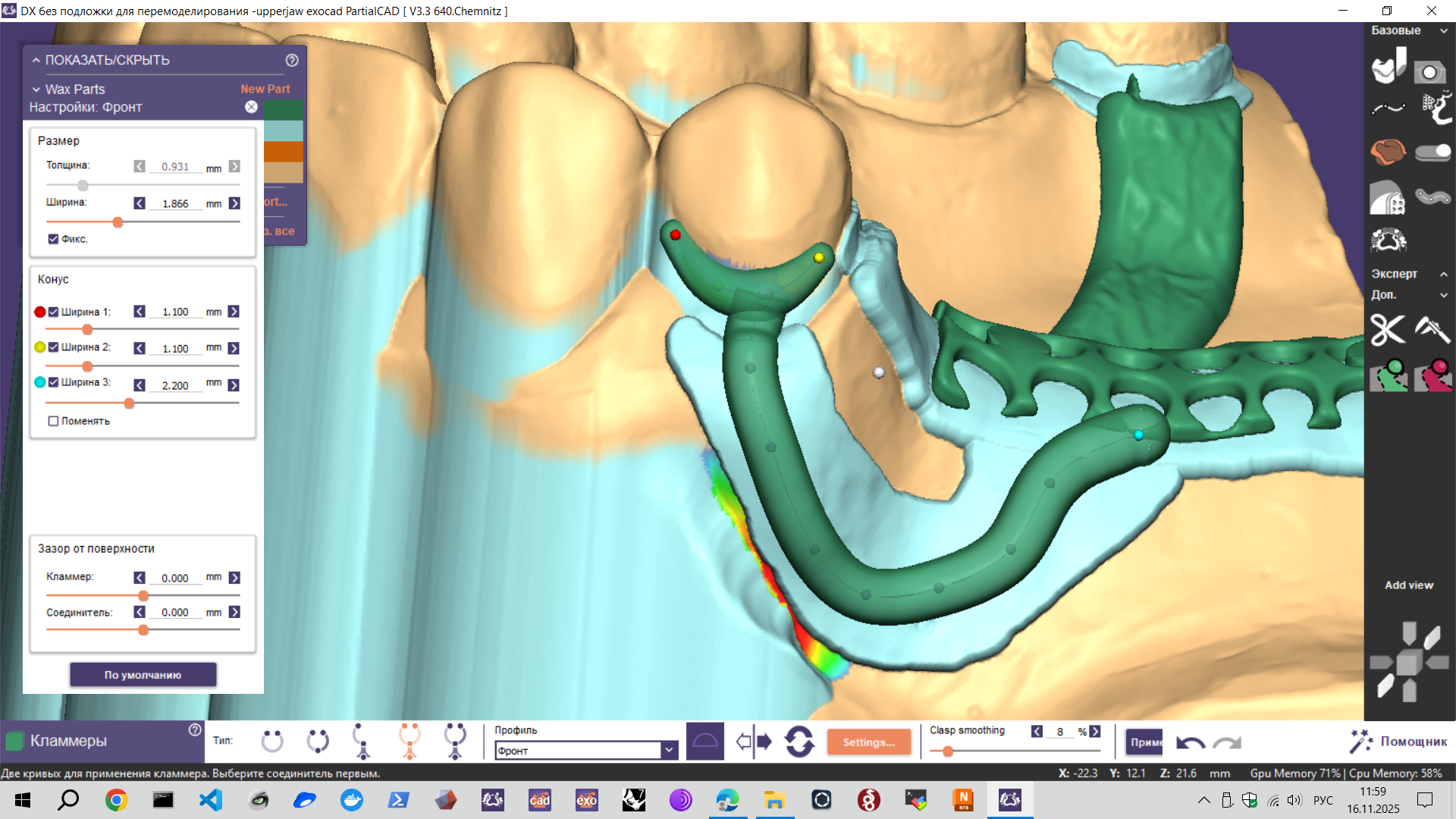 Roach Clasp Modeling